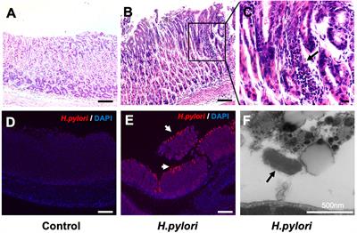 Vitamin D3 Inhibits Helicobacter pylori Infection by Activating the VitD3/VDR-CAMP Pathway in Mice